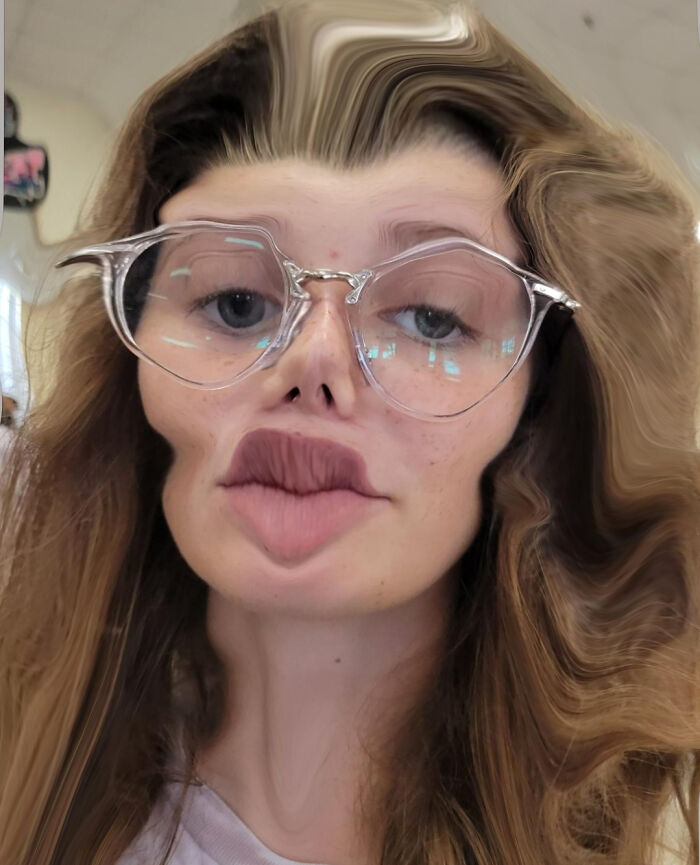 I Decided To Do A Lil Surgery On My Friend