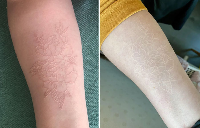 Aged tattoos of floral design on skin showing ink fading over the years.