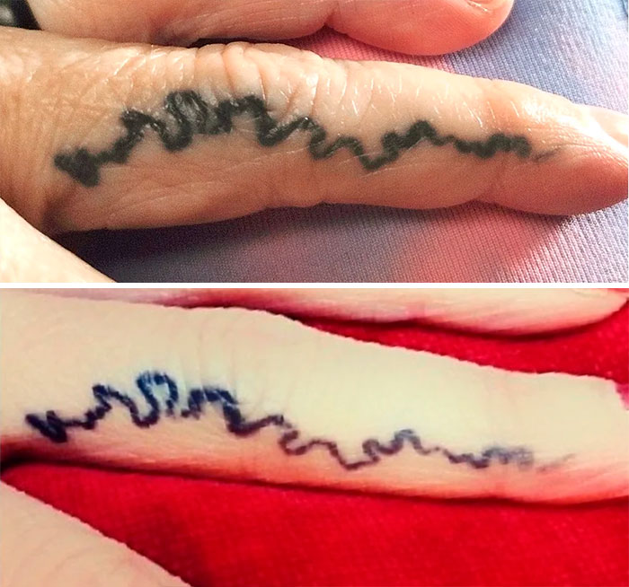 Aged tattoos showing ink changes over the years on a person's finger.