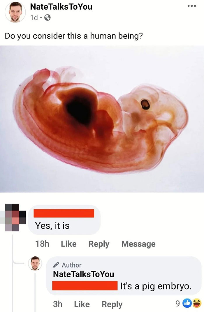 Do You Consider This A Human Being?