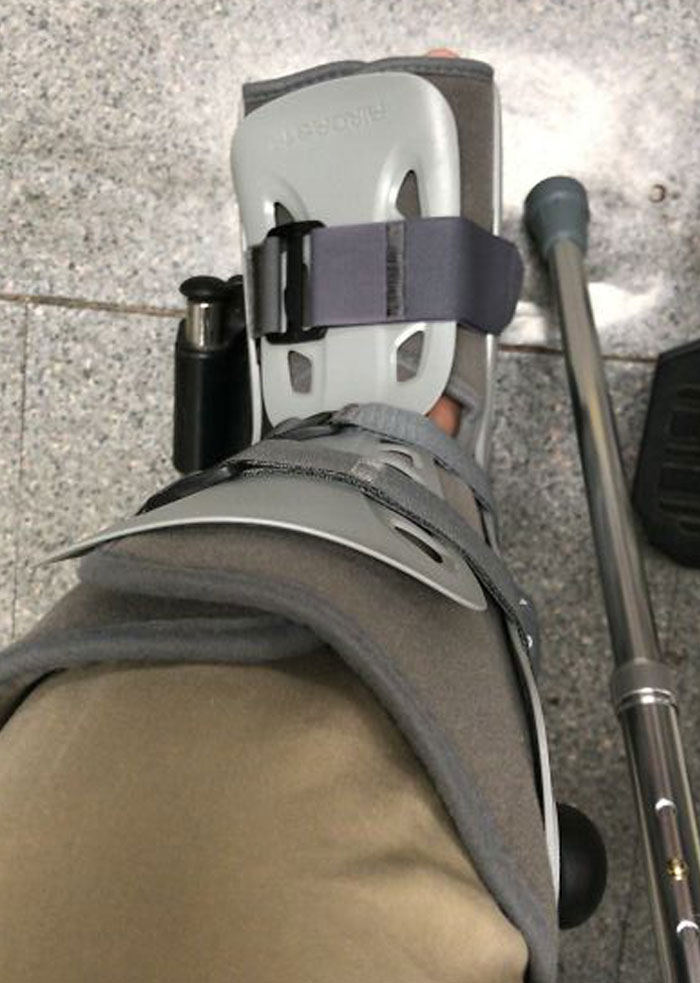 Broke My Leg On The First Day Of Work After Cny, My House Is On Top Of A 200 Steps Hill. Planned To Celebrate Valentine's Day With My Girlfriend Tomorrow