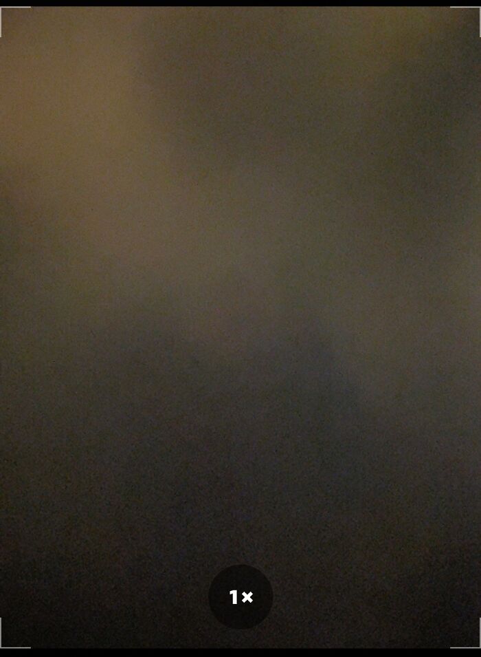 Si Can’t Actually Show You The Scar On My Back. I Fell Out Of A Tree And Had Back Surgery