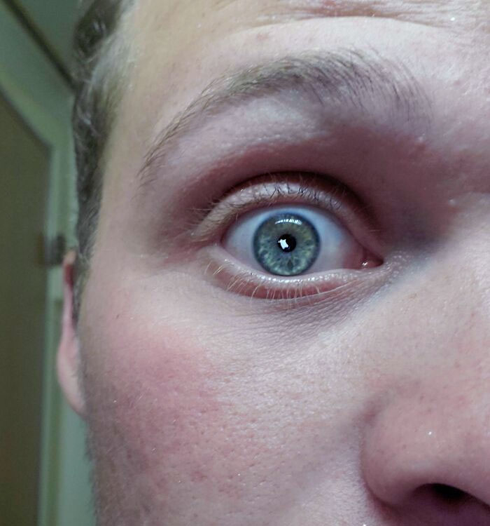 Got A Paint Chip In My Eye Today. Contact Lense Saved Me