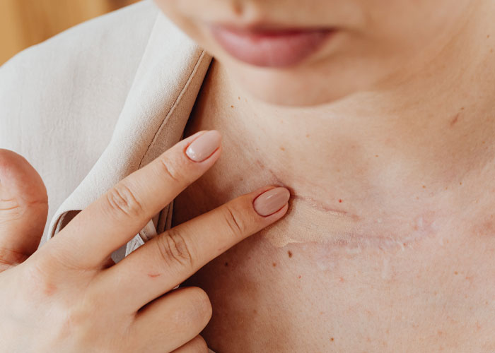 Woman Leaves "Friend's" Wedding After She's Called Out For Not Covering Up Her Skin Condition