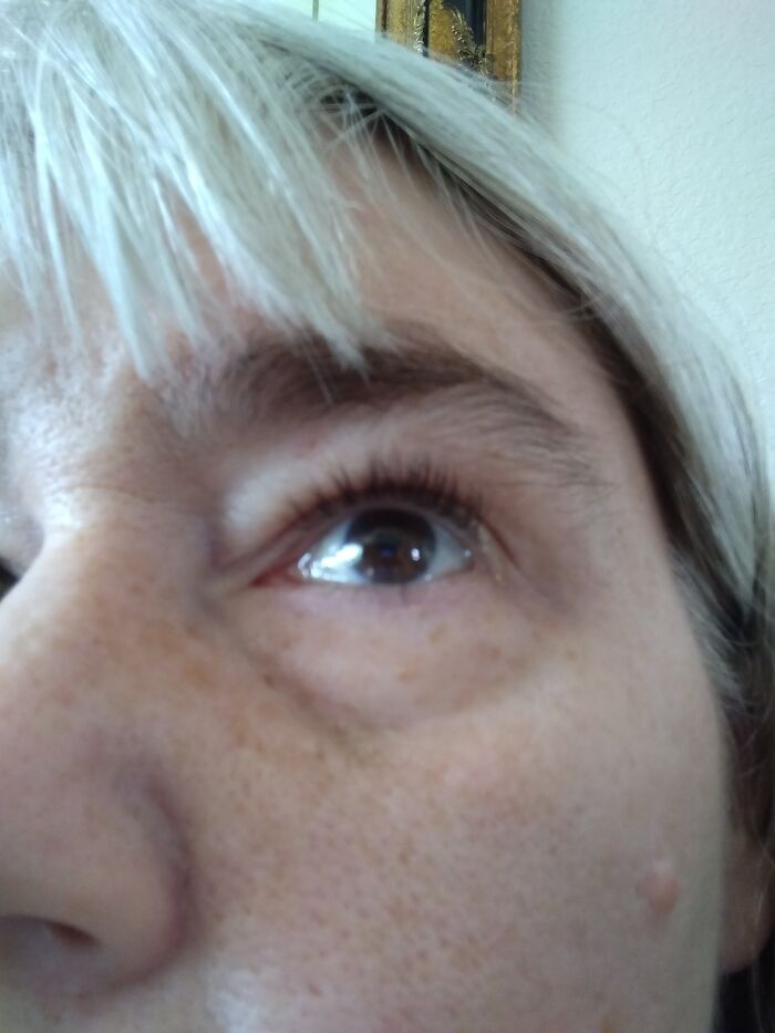 Brown, Freckles And Gray Hair 🧓