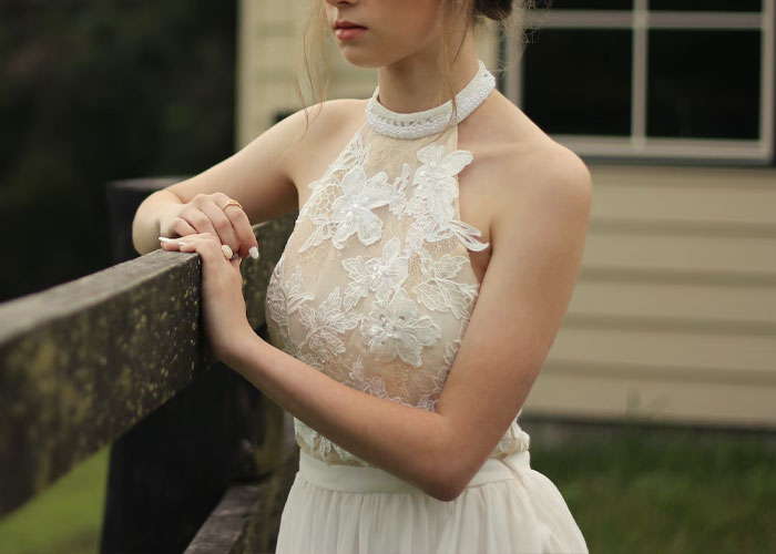 Woman Leaves "Friend's" Wedding After She's Called Out For Not Covering Up Her Skin Condition