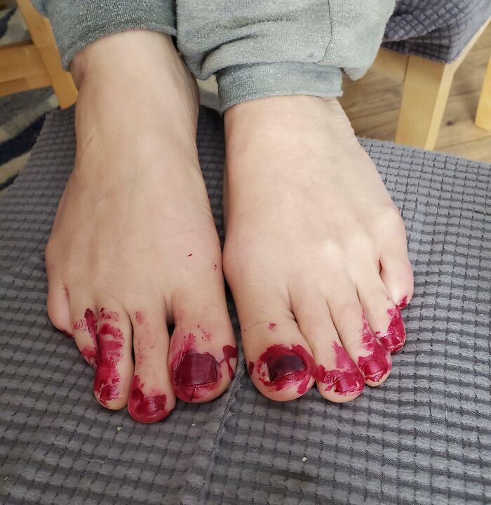 Valentine's Day Pedi From My Daughter! Beautiful