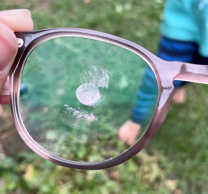 My Kid Slapped My Glasses Directly Into My Eyeball