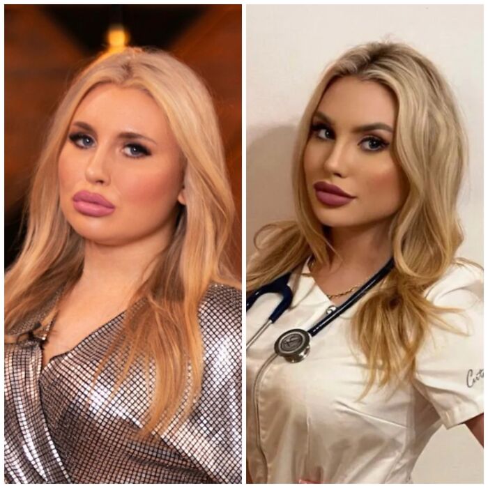 "The Sexiest Doctor" In Our Country, Promo Shot For Reality TV Show vs. Her Instagram