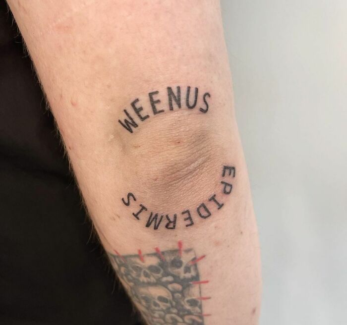 Funny tattoo on an elbow with "Weenus" and "Epidermis" around it.