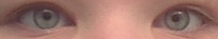 I Have Really Short Eyelashes