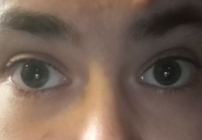 My Eyes Are Greenish Hazel 😊