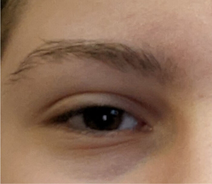 Despite What The Picture Shows, My Eyes Are Brown, Not Black