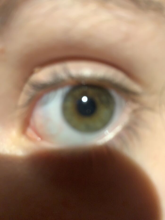 Sorry It’s So Blurry