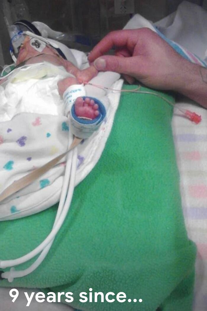 My Granddaughters Tiny Foot She Was 1 Lb 8 Oz At Birth