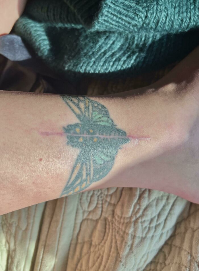 Butterfly tattoo aligned with scar, creating a perfect accidental match on an ankle.