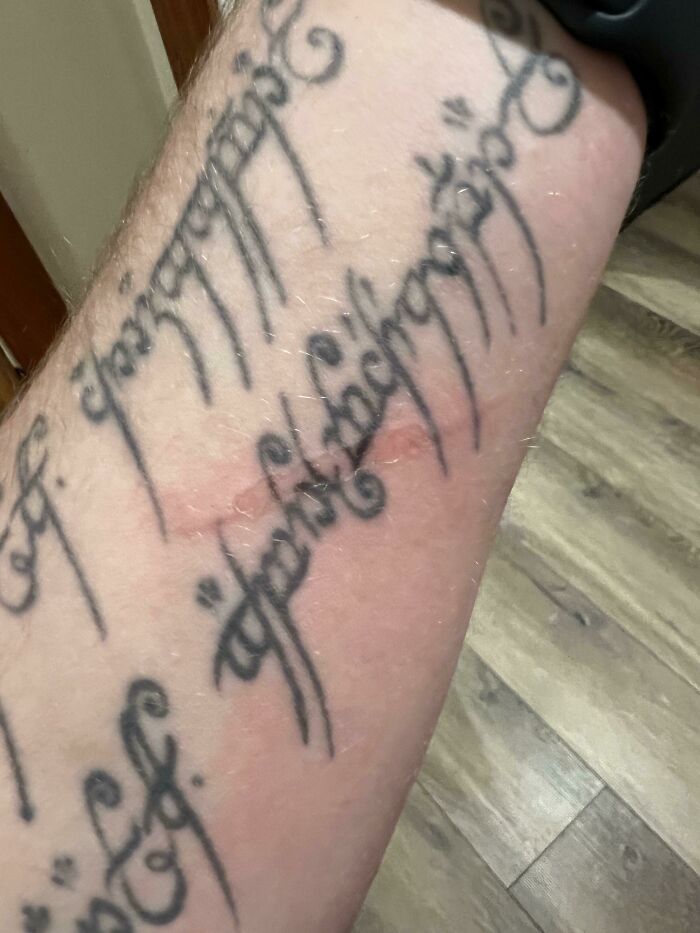 My Tattoo’s Ink Is Far Clearer After Burning Myself On An Oven Pan