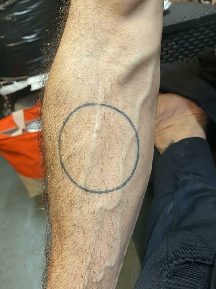 My Dad’s Circle Tattoo Got Misaligned From A Surgery On A Ruptured Tendon