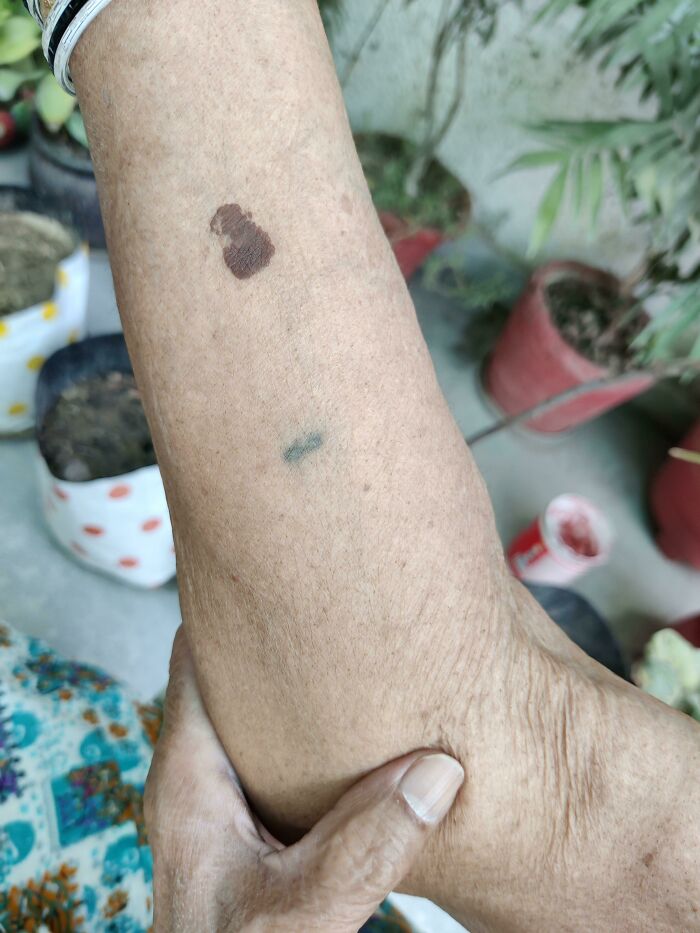 Arm with accidental tattoo resembling a small brown spot, blending with surrounding plants, illustrating tattoo coincidence.