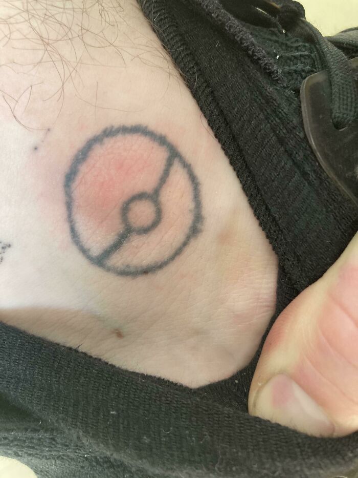 Got A Mosquito Bite On My Pokeball Tattoo, Now It Almost Looks Coloured