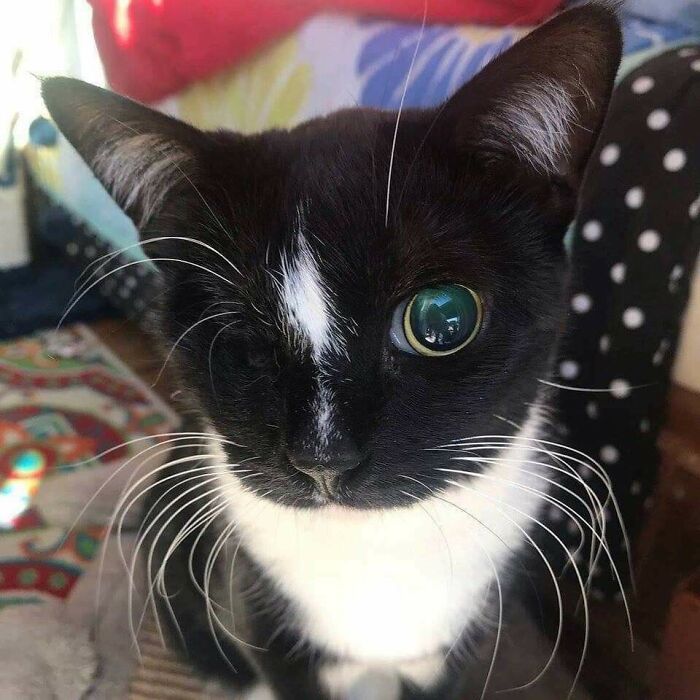 I Hope One Eye Will Do