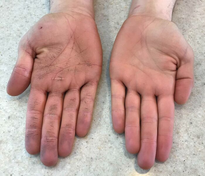 My Job Involves Putting Labels On Boxes, I Hold Them With My Left Hand And Put Them On The Box With My Right. This Is What My “Clean” Hands Look Like