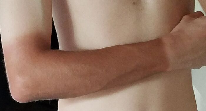 Got A New Job Where I Have To Wear A Uniform And Gloves While Working Outside, Now I Look Like This