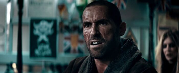 Cain Burgess looks angry 