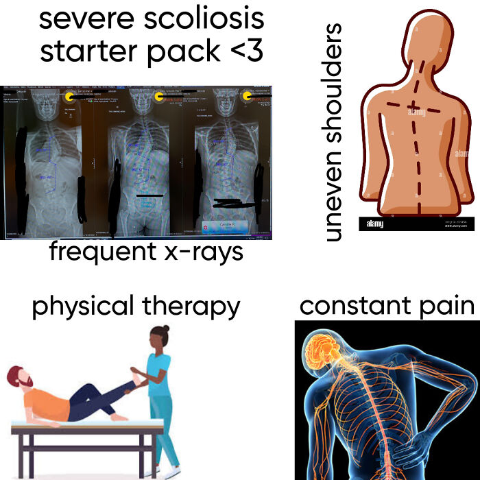 Yes That Is My Real X Ray