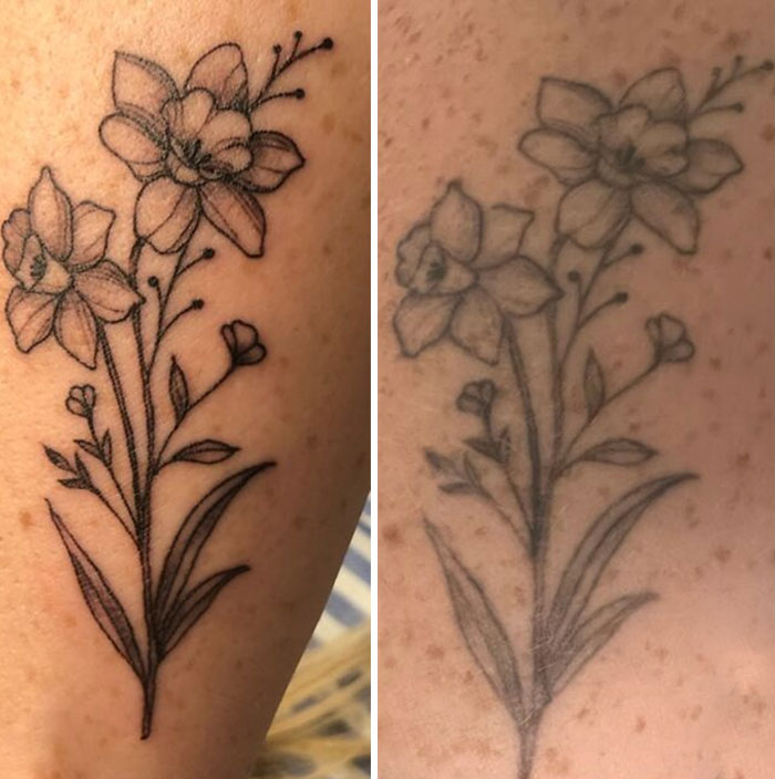 Comparison of aged tattoos, showing fading and blurring over time.