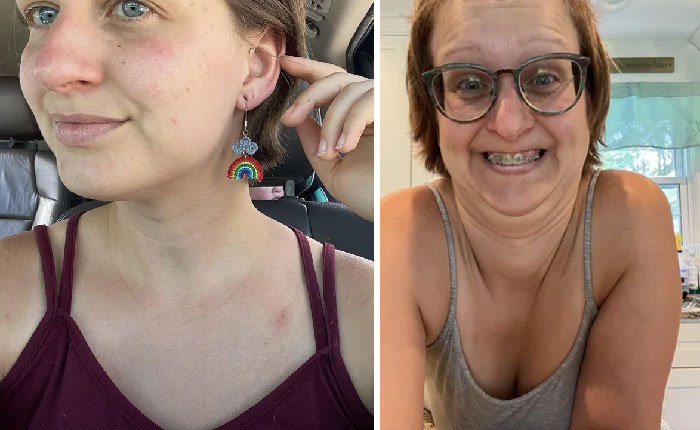 Woman in two photos: left shows her with rainbow earring; right shows her with glasses and braces, funny before and after.