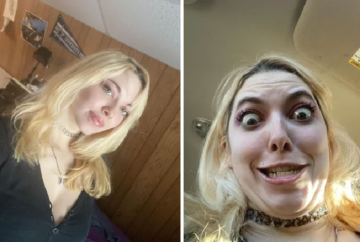 Considering Shaving My Head To Achieve More Of An Egg Look