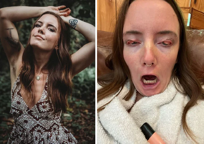 Sometimes This Sun Should Come With A Trigger Warning… Disturbing Image Ahead. You’ve Been Warned