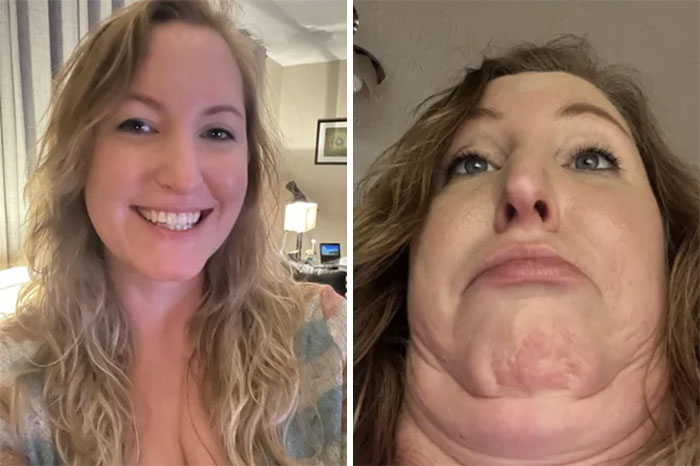 Funny before and after pics of a woman smiling and making a humorous face, showcasing contrast in expressions.