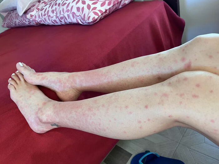 ¡Un mejillón y luego esto!