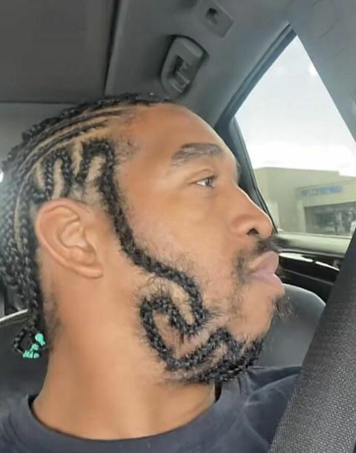 Very Strange Beard Placement