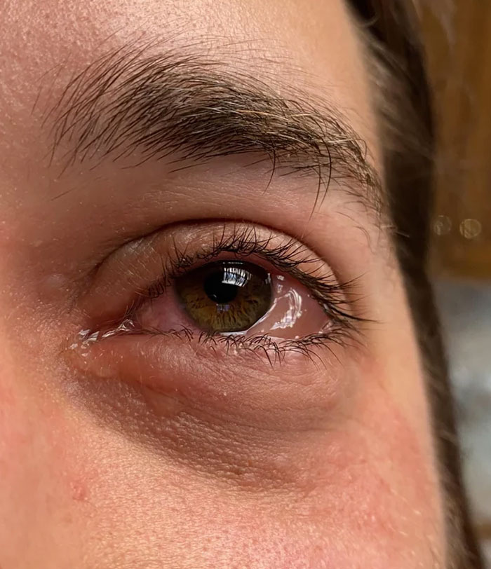 Mi marido es muy alérgico a los perros. Esto es lo que pasó cuando compró una consola de juegos usada a unos amigos que mintieron sobre su casa "libre de mascotas"