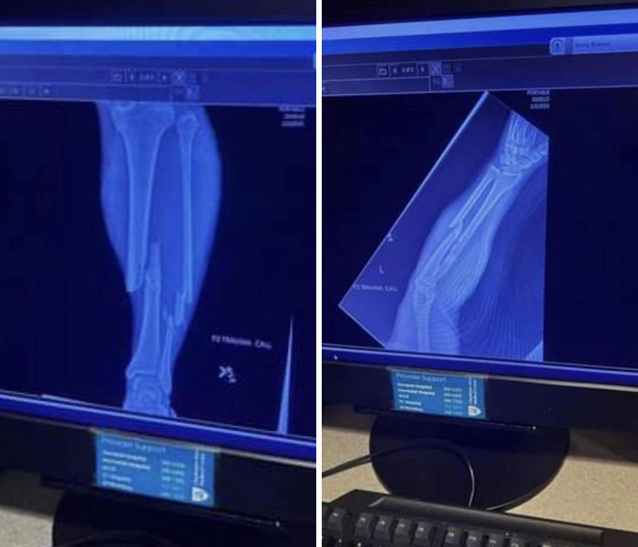 Golpe de lleno mientras conducía una moto de cross