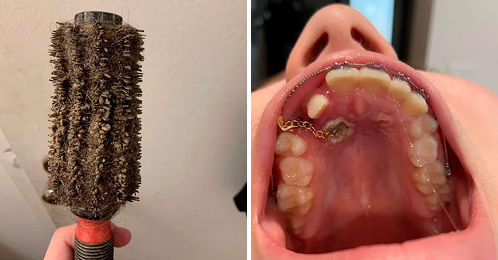 The “Make Me Suffer” Community Posts Unsettling Pics No One Wants To See, Yet They Can’t Stop Looking (30 New Pics)