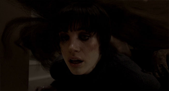 Louise with bruises on her face 