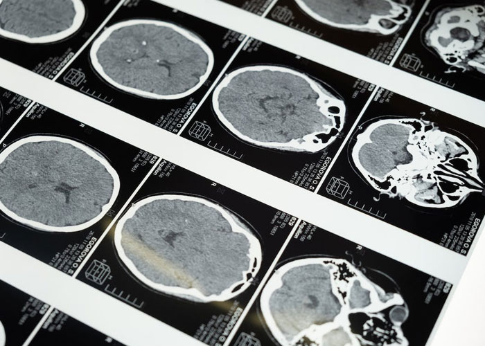 “Human Body Facts That Will 100% Trigger You”: 27 Obscure Yet Terrifying Facts About Us Revealed By This TikToker