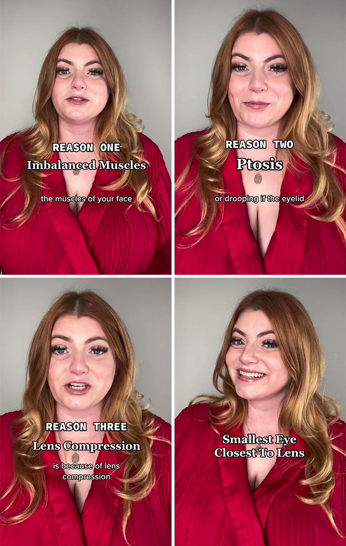 Why One Eye Is Smaller In Photos And How To Fix It