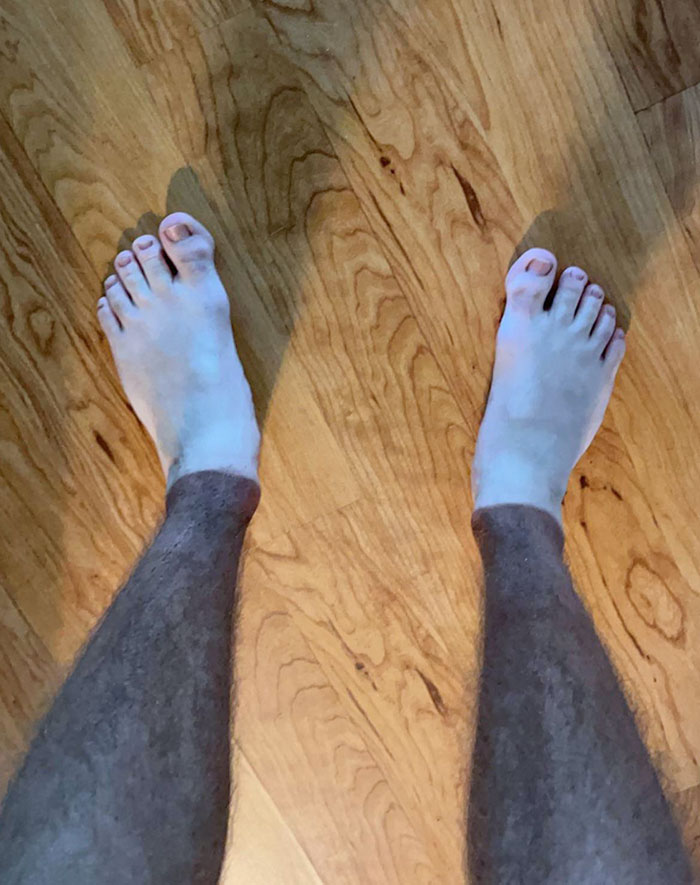 My Tanlines Make Me Look Like I’m Wearing Necro-Pants