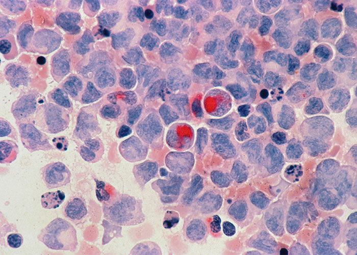 “You Are Hearing Dead People Laugh”: 50 Disturbing Facts That May Leave You Feeling Unsettled