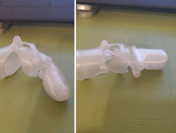 Internet Community Member Who Saw My Post About Insurance Turning Me Down For A Prosthetic Finger Messaged Me A Few Weeks Ago Saying He Would Try To Make One