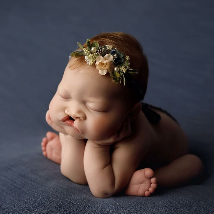 The Heart-Warming Story Of One Photograph: An Image Of A Baby With A Cleft Lip, Making Her Story Go Viral The Heart-Warming Story Of One Photograph: An Image Of A Baby With A Cleft Lip, Making Her Story Go Viral