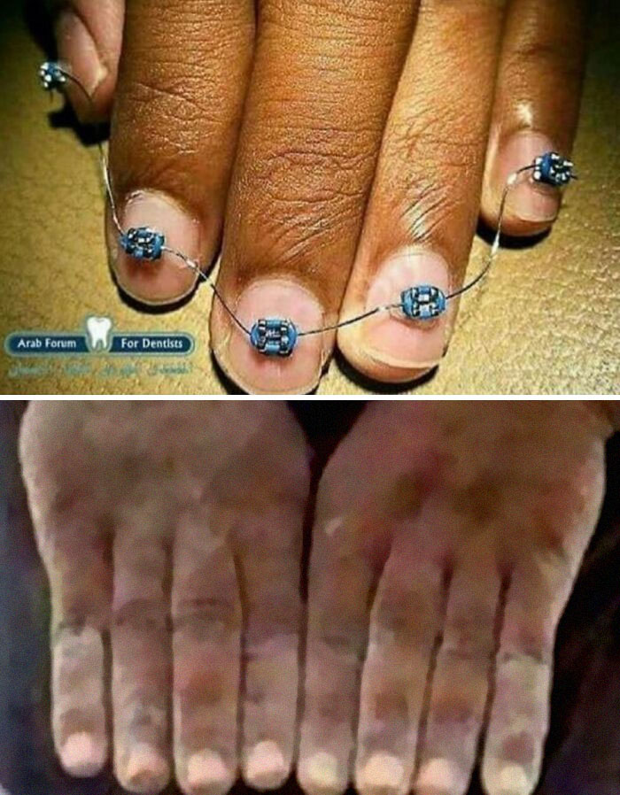 Non-Aesthetic-Things-Pics