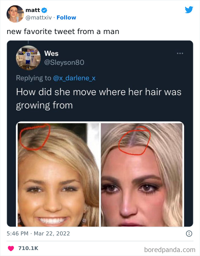 Humorous meme showing hairline change with two photos of a woman, circled in red, relating to female problems.