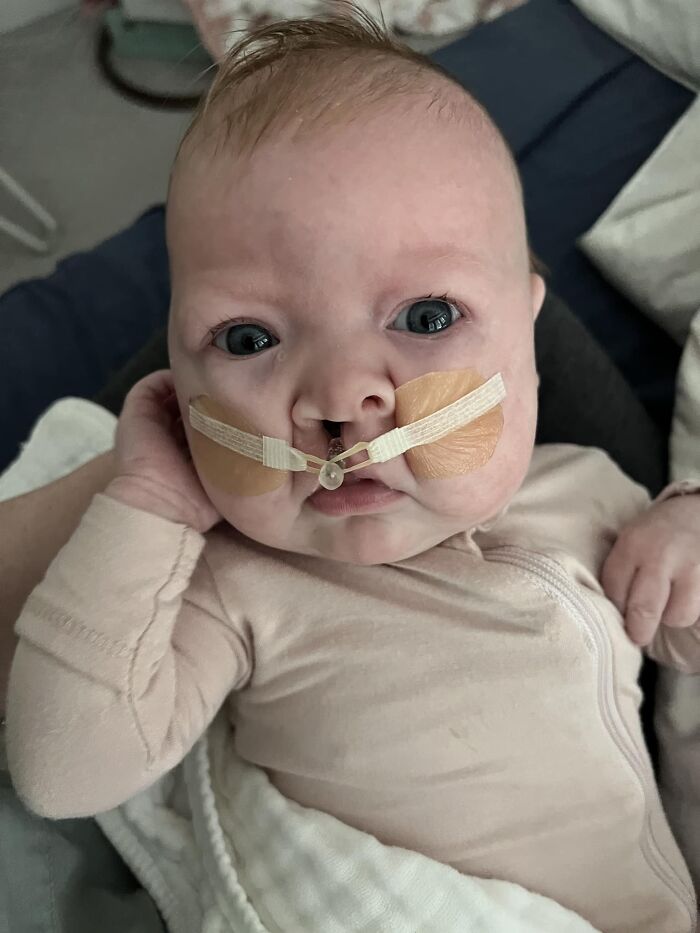 The Heart-Warming Story Of One Photograph: An Image Of A Baby With A Cleft Lip, Making Her Story Go Viral The Heart-Warming Story Of One Photograph: An Image Of A Baby With A Cleft Lip, Making Her Story Go Viral