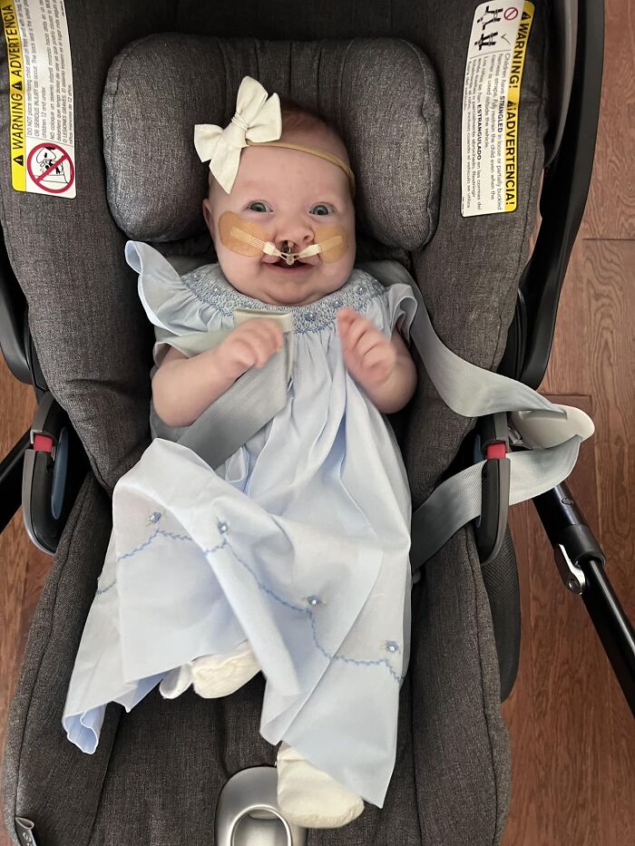 The Heart-Warming Story Of One Photograph: An Image Of A Baby With A Cleft Lip, Making Her Story Go Viral The Heart-Warming Story Of One Photograph: An Image Of A Baby With A Cleft Lip, Making Her Story Go Viral